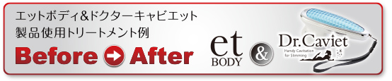 Dr.Caviet BeforeAfter